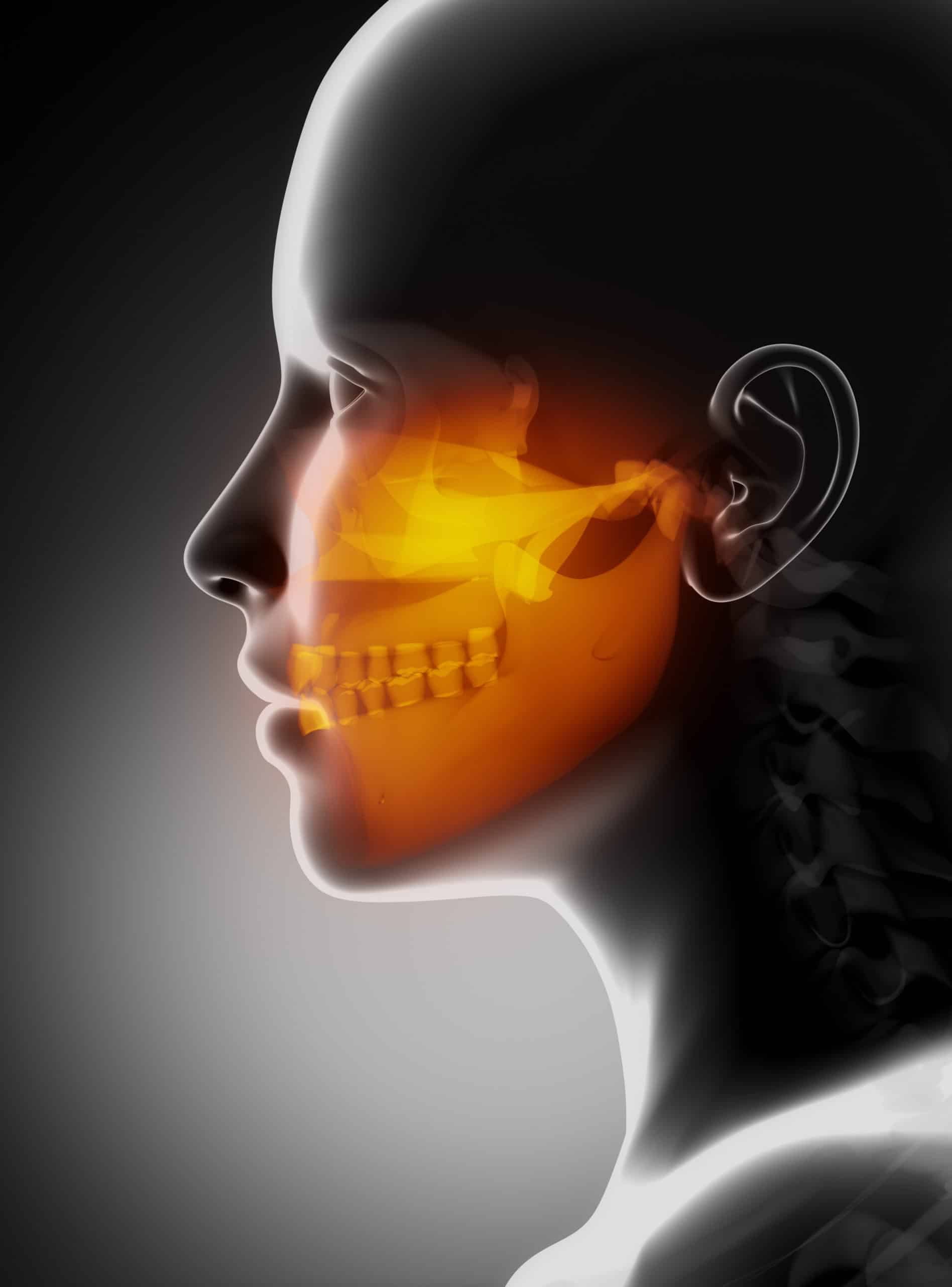 TMJ Disorders: 3 Important Things To Know