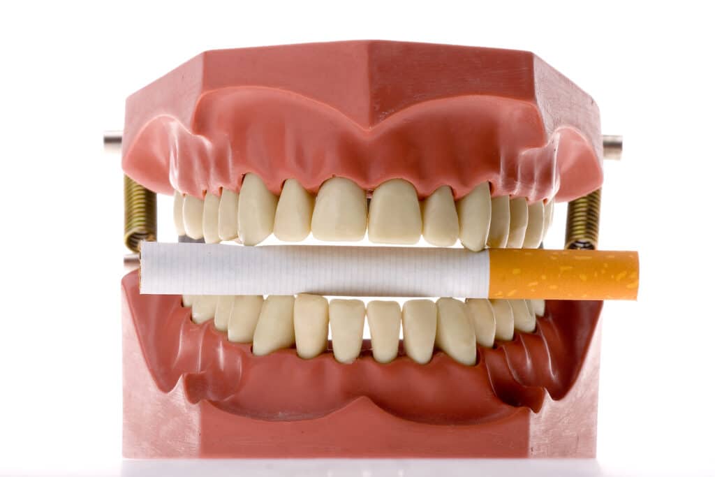 The Destructive Effects Of Tobacco On Oral Health effects of tobacco on oral health Cottonwood Heights UT
