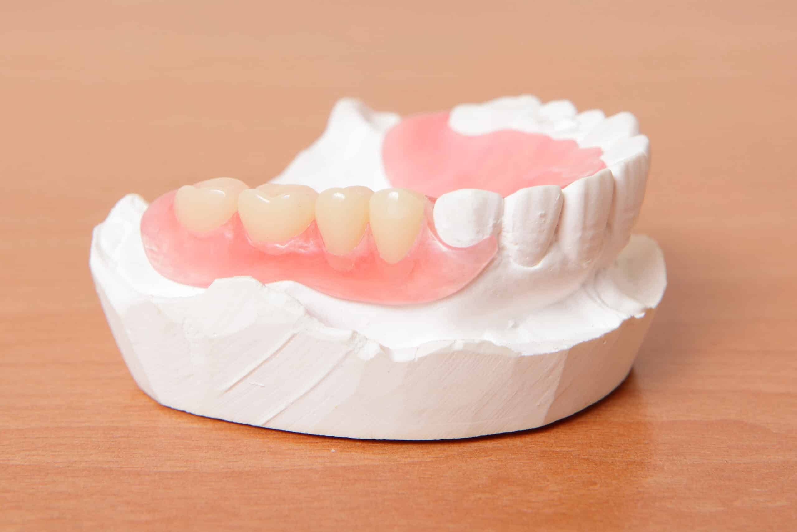 Proper denture care, dental care in Cottonwood Heights, UT